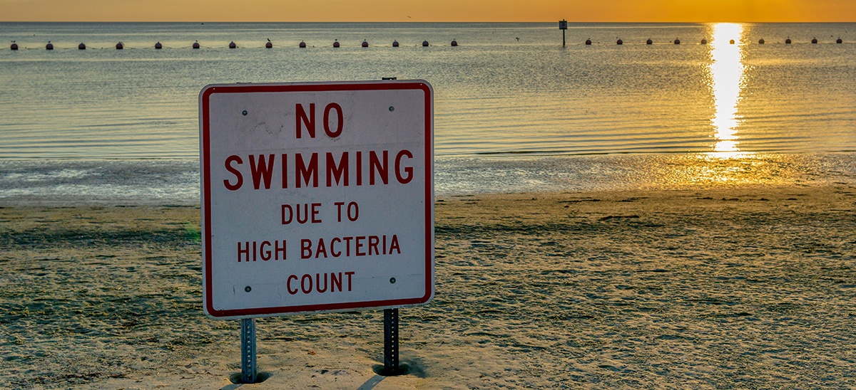 water with too much bacteria